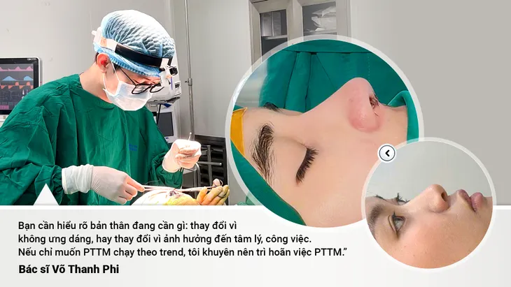 Mũi hỏng sau nâng: Khi nào nên sửa, khi nào nên chờ? - Ảnh 2.