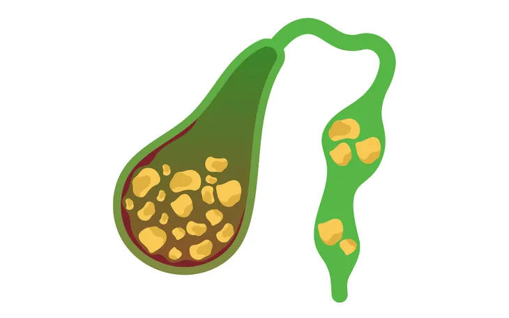 Hình minh họa: Canva