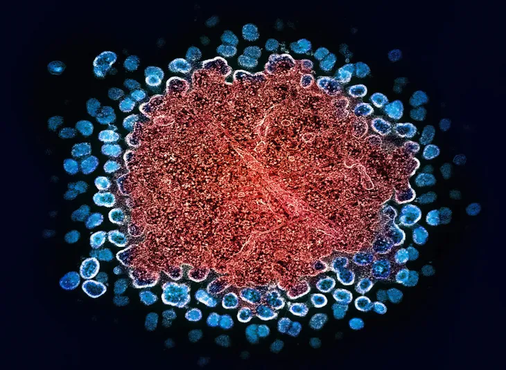 Thái Lan báo động gia tăng ca nhiễm HIV trong giới trẻ- Ảnh 1. Thái Lan báo động gia tăng ca nhiễm HIV trong giới trẻ- Ảnh 1.
