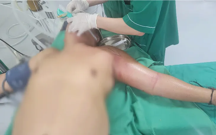 Người đàn ông hoại tử cánh tay vì tự tiêm mật gấu chữa bệnh 
