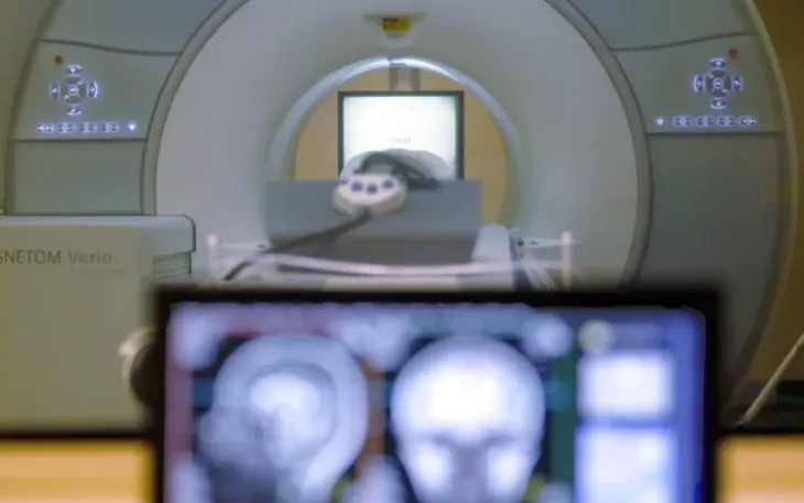 Một máy chụp MRI não (Ảnh: AP)