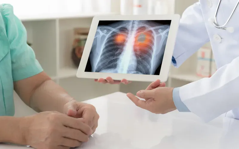 9 biện pháp giảm nguy cơ mắc ung thư