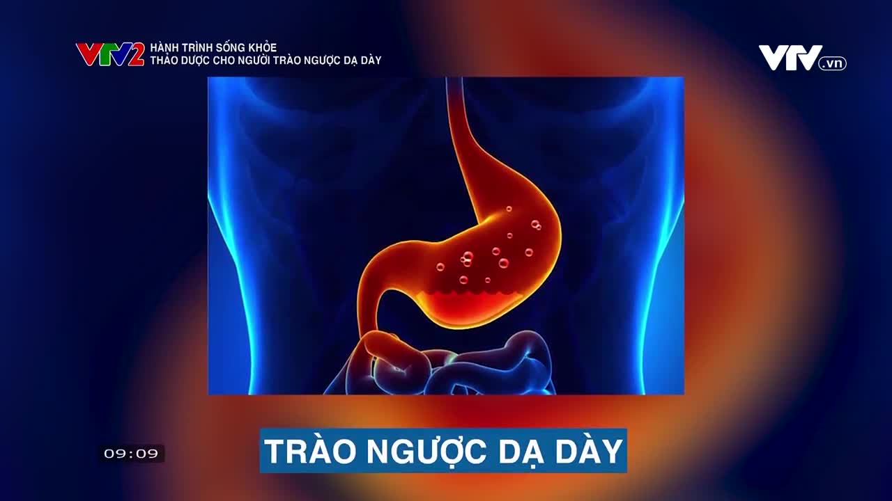 Hành trình sống khỏe: Thảo dược cho người trào ngược dạ dày