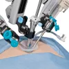 Robotics surgery benefits patients