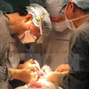 4,000 children with harelip undergo surgery