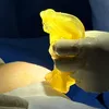 Dissection Technique and LMA Anesthesia for Breast Implants: The Optimal Solution?