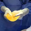 A rare case of bilateral breast implants with different implant types