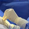 Causes of early breast implant rupture