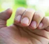 Cảnh báo từ cơ thể: 5 dấu hiệu cho thấy bạn đang thiếu chất dinh dưỡng