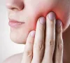 Những dấu hiệu cảnh báo ung thư khoang miệng