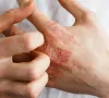 Câu chuyện về nỗi ám ảnh "nửa sống nửa chết" vì loại thuốc hàng triệu người tin dùng