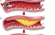 Chất lượng cuộc sống 