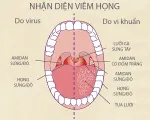 Kháng sinh không phải phao cứu sinh với bệnh viêm họng virus