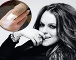 Lindsay Lohan đau đớn vì tai nạn kinh hoàng