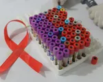 Hôm nay (1/12), ngày Thế giới phòng chống AIDS