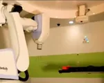 Hệ thống xạ trị bằng robot Cyberknife giúp loại bỏ các khối u não