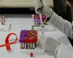 Cuba thử nghiệm vaccine điều trị HIV/AIDS