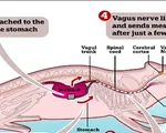 Thiết bị phát tín hiệu báo - giải pháp điều trị cho chứng béo phì