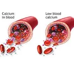 Điều gì xảy ra khi mức canxi cao?