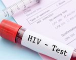 Thử nghiệm thành công giai đoạn đầu vaccine mới phòng HIV/AIDS