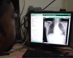Vaccine lao mới có thể cứu sống hàng triệu người