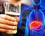 Tìm ra cách  đảo ngược bệnh viêm gan do rượu bia