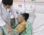 Nam thanh niên xẹp phổi sau 5 năm hút thuốc lá
