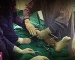 Kéo dài chân có suy giảm tuổi thọ?