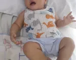 Bệnh nhi tim bẩm sinh 8 tháng tuổi nguy kịch vì không có tiền phẫu thuật
