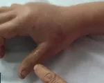 Đề phòng bị rắn tấn công trong mùa mưa