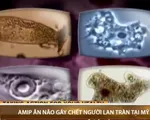 Mỹ : Amip ăn não gây chết người lan tràn qua hệ thống nước ngọt