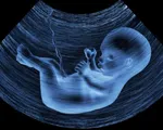 Phát hiện hạt vi nhựa trong nhau thai của người
