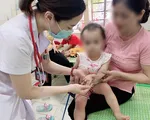 Cả nước ghi nhận 10.745 ca mắc tay chân miệng