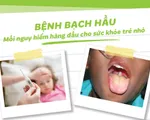 Bệnh bạch hầu nguy hiểm thế nào với trẻ nhỏ?