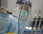 Xét nghiệm phát hiện virus SARS-CoV-2 qua chất thải của ca bệnh không triệu chứng