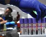 Gia tăng nhanh chóng các vùng lây nhiễm COVID-19 tại Indonesia