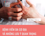 Bệnh viêm da cơ địa và những lưu ý quan trọng