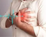 4 tình trạng sức khỏe này có thể khiến bạn dễ bị đau tim