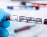 WHO họp khẩn vì ổ dịch sốt xuất huyết do virus Marburg