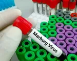 Những điều cần biết về bệnh do virus Marburg