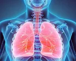 Viêm phổi ở bệnh nhân đái tháo đường
