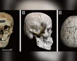 Bí ẩn về những hộp sọ Nhật Bản cổ đại bị “biến dạng”