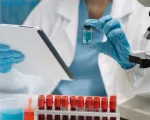 Nga phát triển vaccine ngừa virus Marburg gây chết người