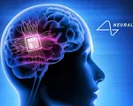 Người đầu tiên được cấy chip não của Neuralink giờ ra sao?