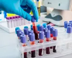 Hơn 40% người Việt có cholesterol máu cao