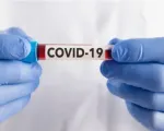 Diễn biến COVID-19 tại TP Hồ Chí Minh
