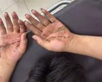 Cảnh báo tai nạn điện giật khi thả diều