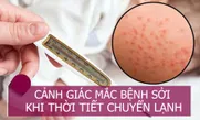Cảnh giác mắc bệnh sởi khi thời tiết chuyển lạnh
