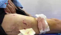Alo Doctor - 06/5/2025