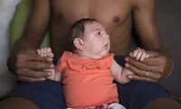 WHO warns Zika could get worse